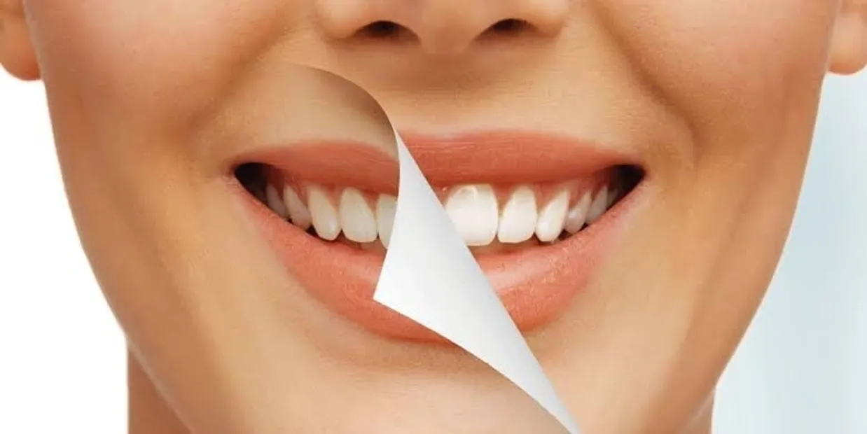 Why Is Nutrition So Important for Strong Teeth and a Healthy Smile Hemel?
