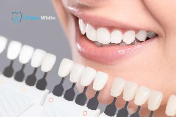 How to Maximise the Results of Your Laser Teeth Whitening Treatment Hemel