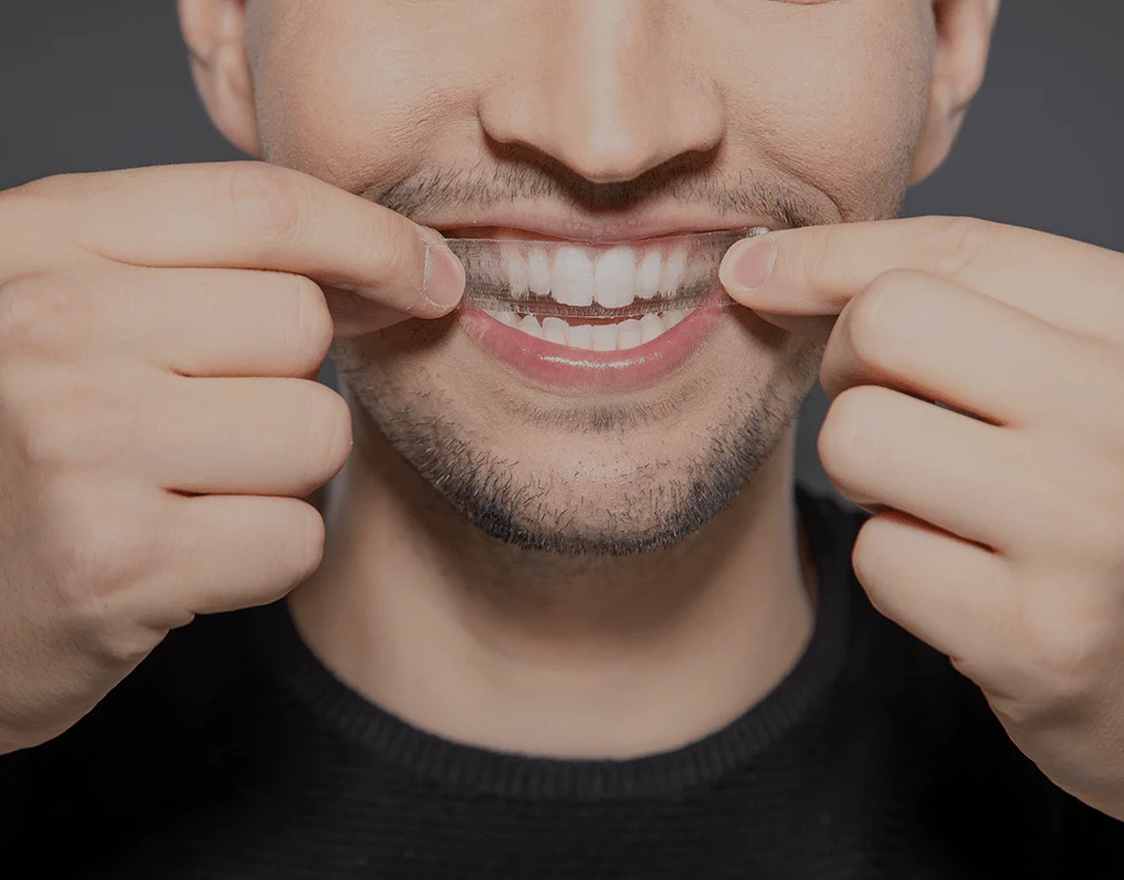 How Are Invisible Aligners Changing Orthodontic Treatments Hemel?