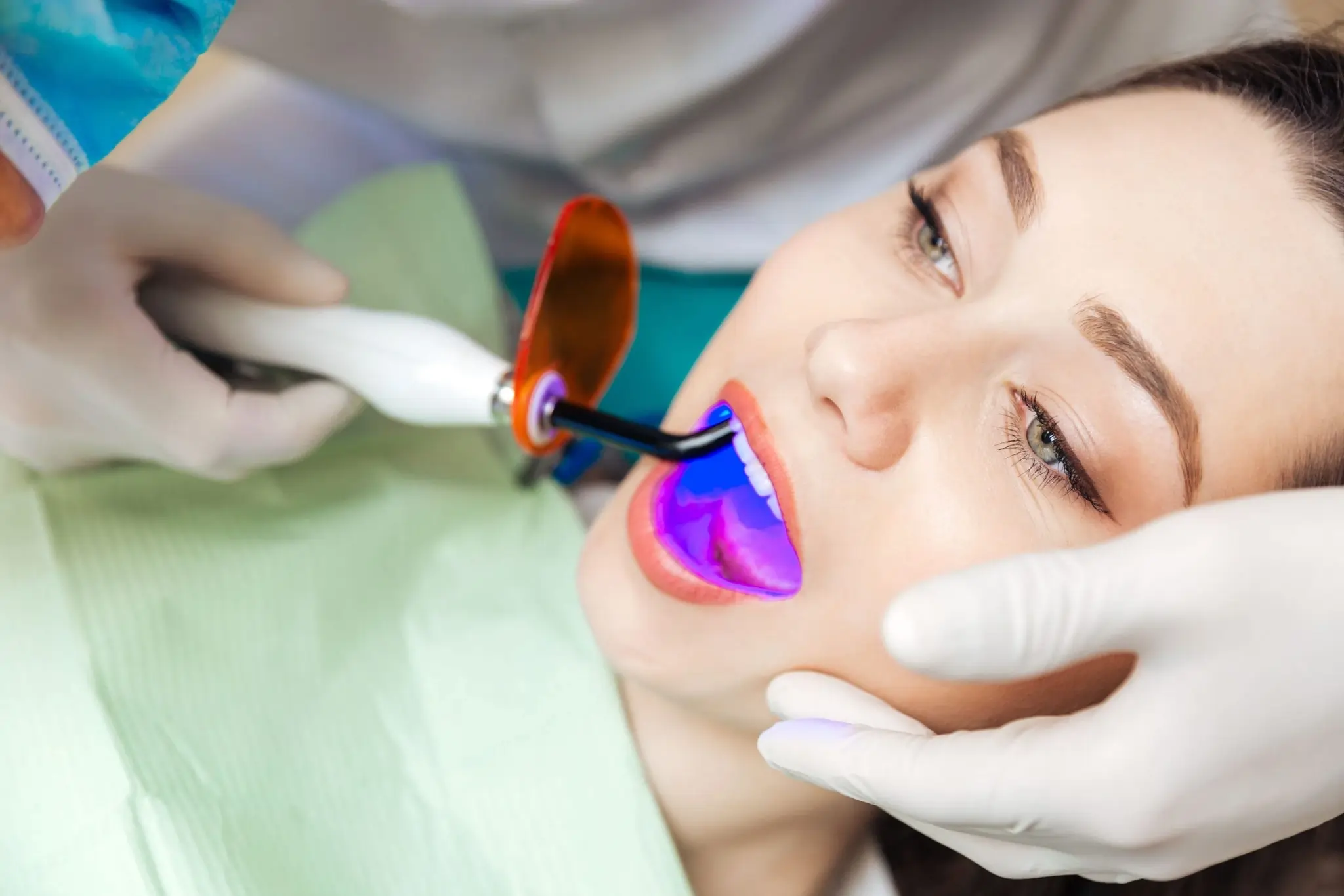 How Fast Can You See Results with Laser Teeth Whitening Hemel?
