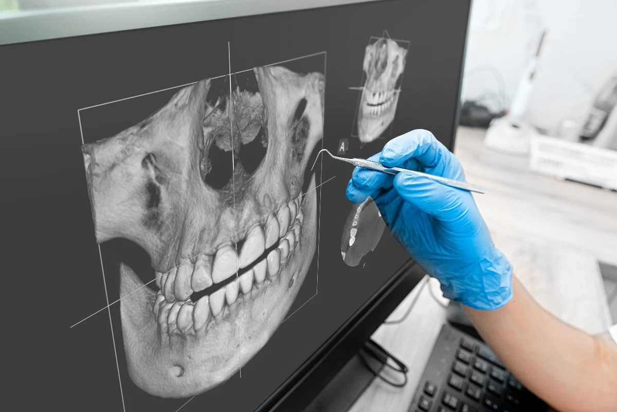 Key Benefits of 3D Printing for Patients and Dentists Hemel