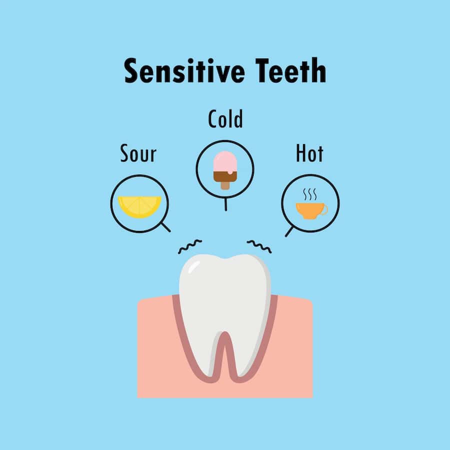 How Can You Tell If Your Teeth Are Becoming Sensitive Hemel?