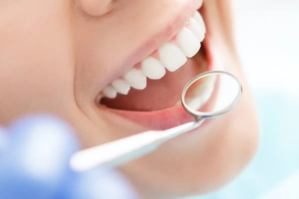 How to Maintain Your Whiter Smile After Treatment Hemel