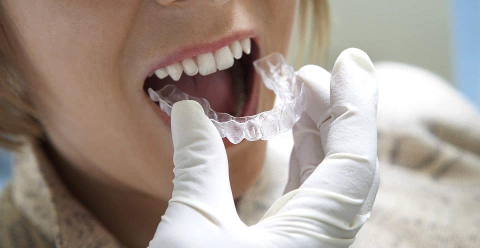 Can Bruxism Affect Your Sleep Quality Hemel