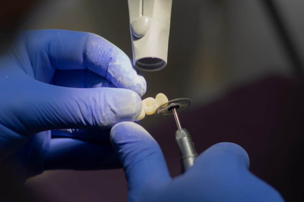Customised Dental Solutions: Crowns, Aligners, and Implants Hemel