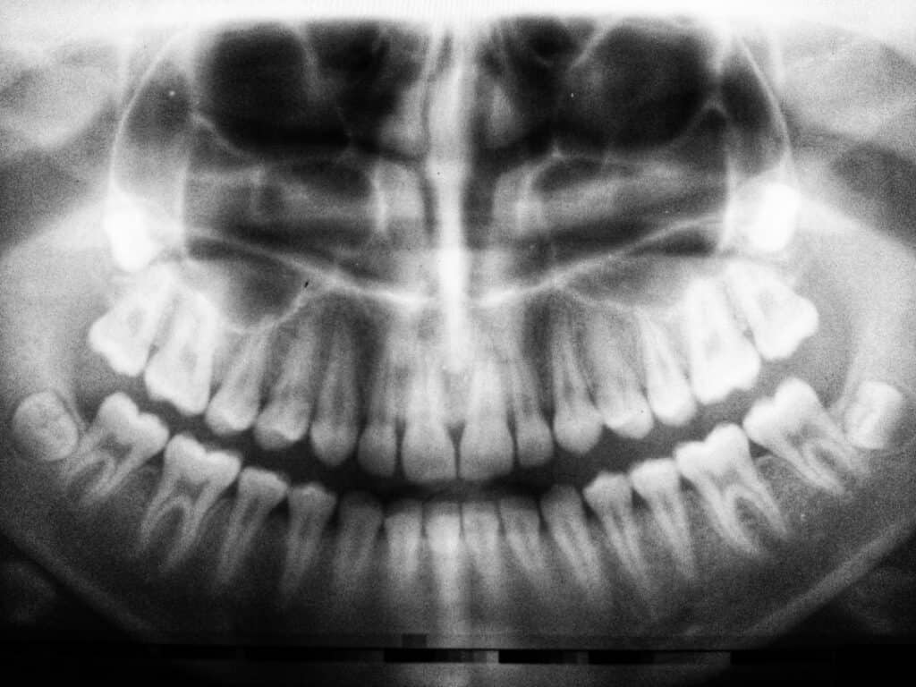 The Future of 3D Printing in Oral Healthcare Hemel